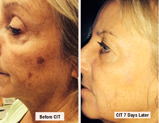 264721 Beauty Everlasting CIT Results